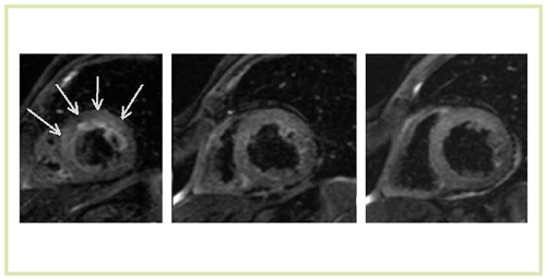 }5@}S؍[ǏǗi60ΑCjjT2摜 ib}black blood TSEjiTitan 3Tj SNR╂S؁CS؂CNR
