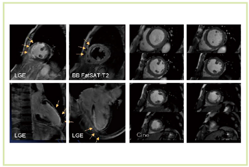}6@SMRI(1)iTitan 3Tj