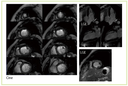 }7@SMRI(2)iTitan 3Tj