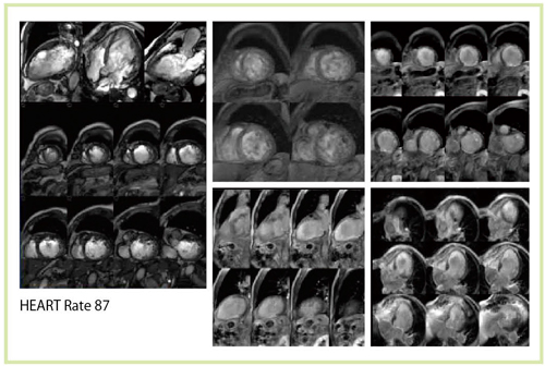 }8@87bpm̍SȔ팟҂̐SMRIiTitan 3Tj