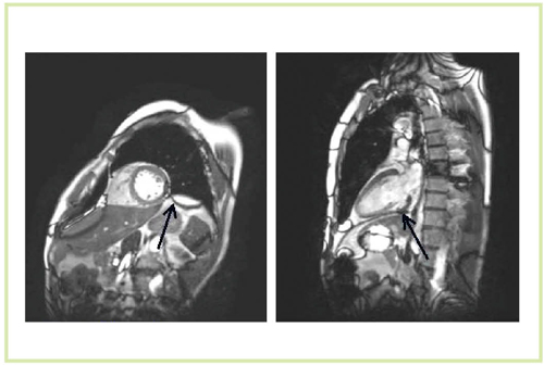 }9@3T MRIɂ鐳{eBÃVlMRI A[`t@NgofBOA[`t@NgڗB TR/TE4.2/2.1CFA46