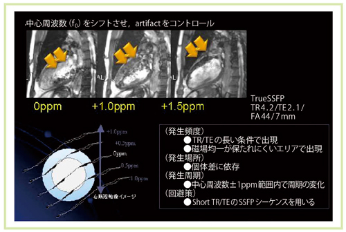 }10@banding artifact̉