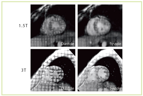}12@1.5T3Tłtagging@̔r T1ɘaԂ̉ɂCtaggingWԎB 