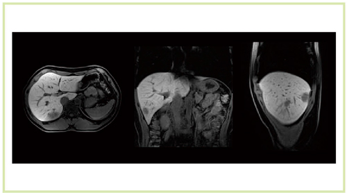 }14@̍זEǗiTitan 3Tj ̍זE TR/TE3.7/1.3@MX588*640 NS100@ST2@Time19s