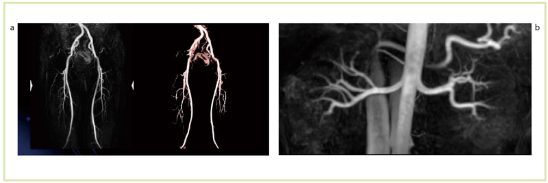 }16@񑢉eMRAiTitan 3Tj aFMRAiFBI@j TR/TE3423/60@ST1.0@NS100 bFtMRAiTime-SLIP@j TR/TE4.8/2.4@ST1.0@NS80