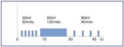 }8@4D-CT angiographyi3D-CT-DSACT󗬉摜j̃XLvgR[