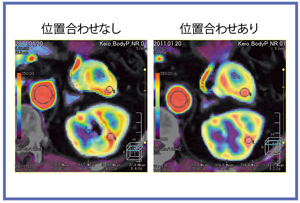 }1@Body Registration 