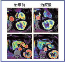 }2@ ÑOperfusion MAPr 