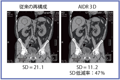 }5@AIDR 3DgpL̔riPCTj
