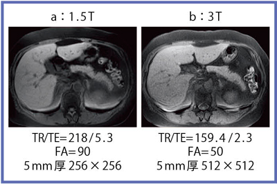 }4@T1摜2D GR in-phaseb}