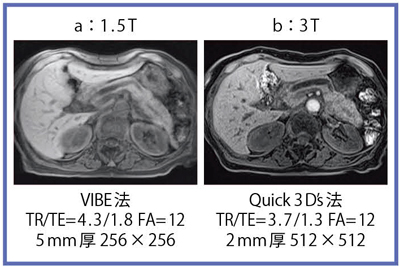 }5@T1摜3D spoiled GRb}