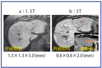 }6@HCCɂGd-EOB-DTPAe\