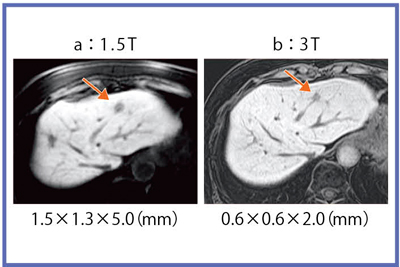 }10@HCCǗFGd-EOB̍זE̍\摜