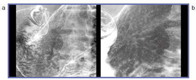 }3@ I.I.iajFPDibj̉掿̔r