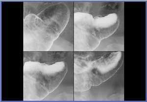 }9@ Ǘ1F[`BeŔꂽ Ucla