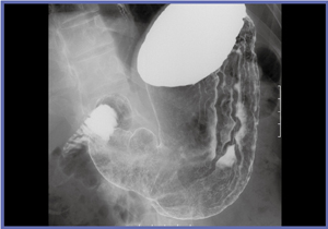 }11@ Ǘ3FfŔUcaρC [Os