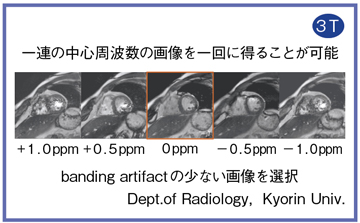 }2@f0 prep@\Fbanding artifact̏Ȃ摜I