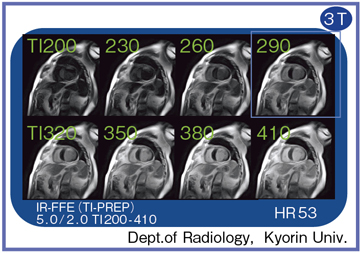 }5@TI prep@pčœKTIlI
