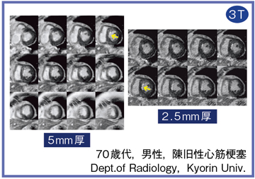 }6@xeMRIF[Bx̒Ⴂ[ǂ̕]
