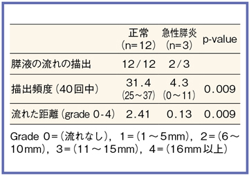 }3@Ƌ}XTime-SLIPpcine dynamic MRCPɂXt̗̔r