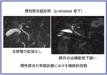 }4@Time-SLIPpcine dynamic MRCPɂXtro̕]