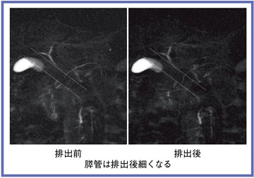 }5@Time-SLIPɂXtroOXǌ`ԕω