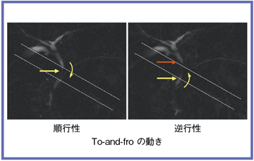 }6@Time-SLIP ɂXtroOXǌ`ԕω