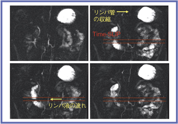 }8@Time-SLIPɂ̃pt̗̕`o