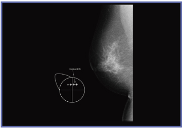 }4@Exam-Marker͗Fpፍ