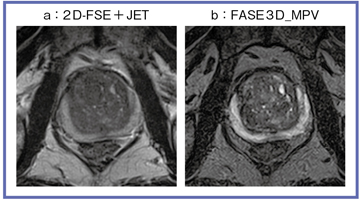 }1@FASE3D_MPV2D FSE@ɂT2摜̔r JETF̓␳@̃IvV\tgEFA