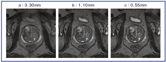 }2@FASE3D_MPVMPR̍č\XCXω