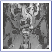 }3@Enhanced Fat FreeɂψȍL͈͎b}摜