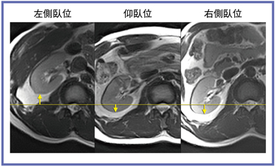 }7@̈ʂɂt̕ΈʁiEtj
