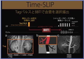 }1@Time-SLIP@p񑢉eMRǍ