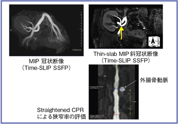 }4@Ǘ2FڐAtǗi70ΑCC̐tڐA5Nj