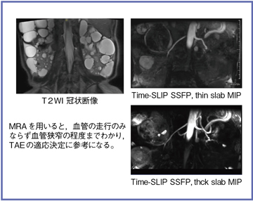 }6@Ǘ4FADPKDɂt̕`oi60ΑCj