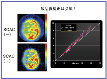 図1 散乱線補正の効果