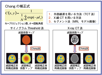 図2 減弱補正の方法