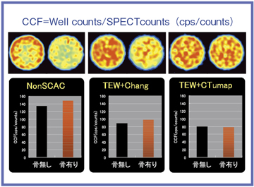 図3 散乱線補正,減弱補正の有無によるCCF値の違い