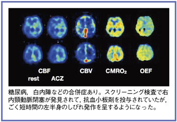 }1@Ǘ1FE򓮖ǁi60΁Cj̏pOPET摜
