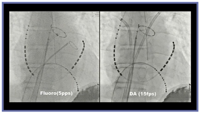 }2@ʓƎBẻ掿r PureBrainŒ񋟂ʓ[hƎBe rĂfoCX͏\ȎFĂB 