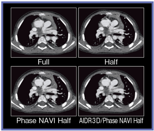 }4@n[tč\Phase NAVICAIDR 3Dɂ{[XL̉掿r