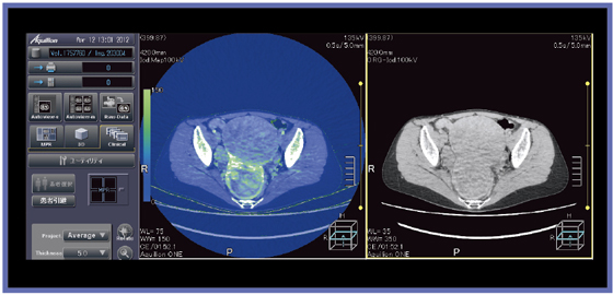}6@AIDR 3Dgpdual energy imaging̉z񑢉e摜