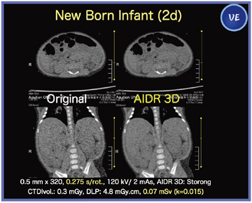 }1@ǗPFVɂAIDR 3Dɂ΂ቺ