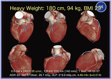 }3@Ǘ3F̊ȋ傫Ȕ팟҂cardiac CT