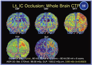 }5@Ǘ4FS]CT perfusion