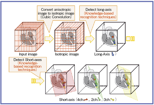 図4 CardioLineの原理イメージ