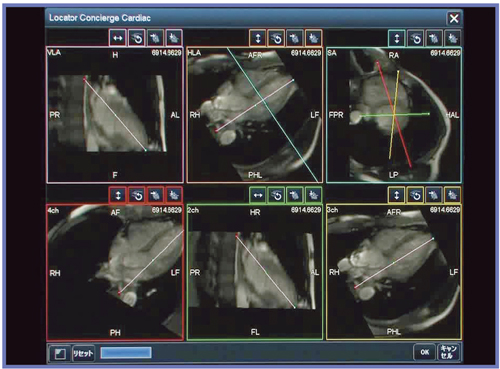 図5 CardioLineの画面 自動で位置決めされた6断面が表示される。