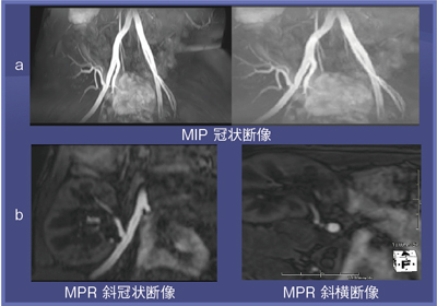 }2@Ǘ2FڐAt̐MRAiTime-SLIP@pSSFPC30ΑCC̐tڐA5Nj