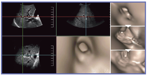 }1@Fly Thruʁ@67΁CC̓_ǁE_Ǌgi\wj